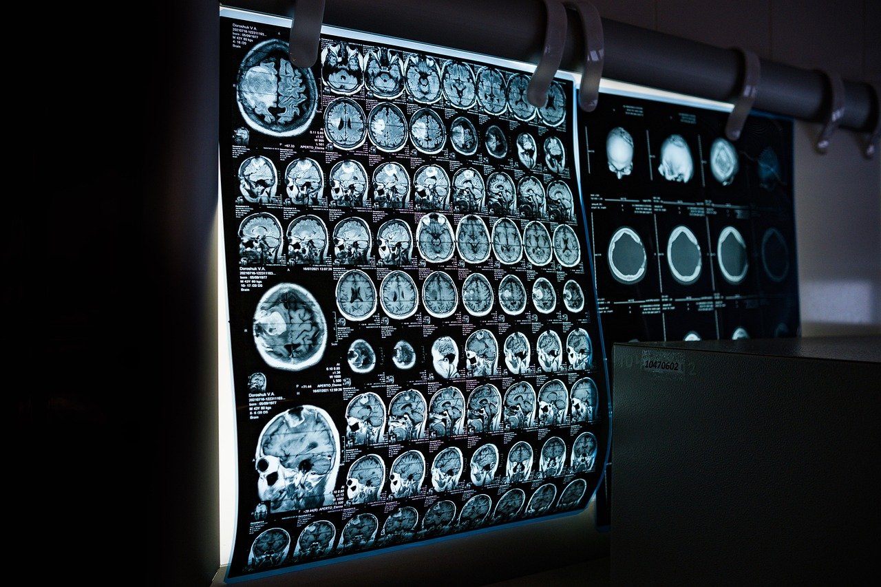 x-ray, mri, ct scan