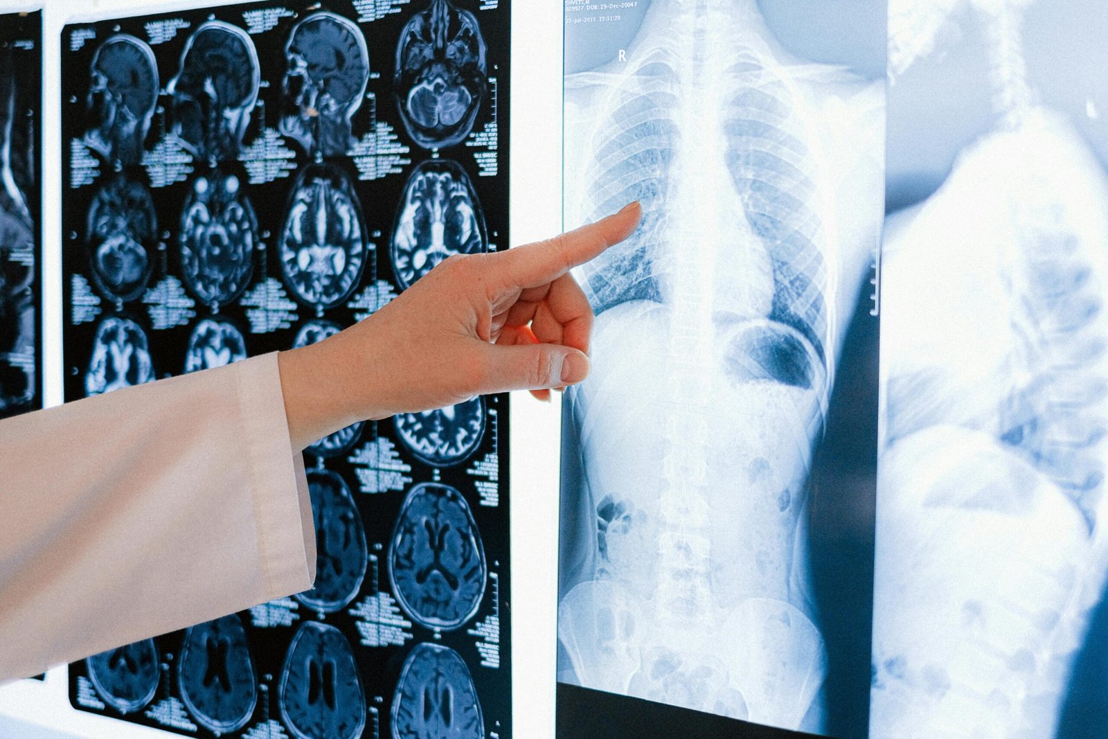 A doctor pointing at a chest X-ray among MRI scans in a medical clinic.