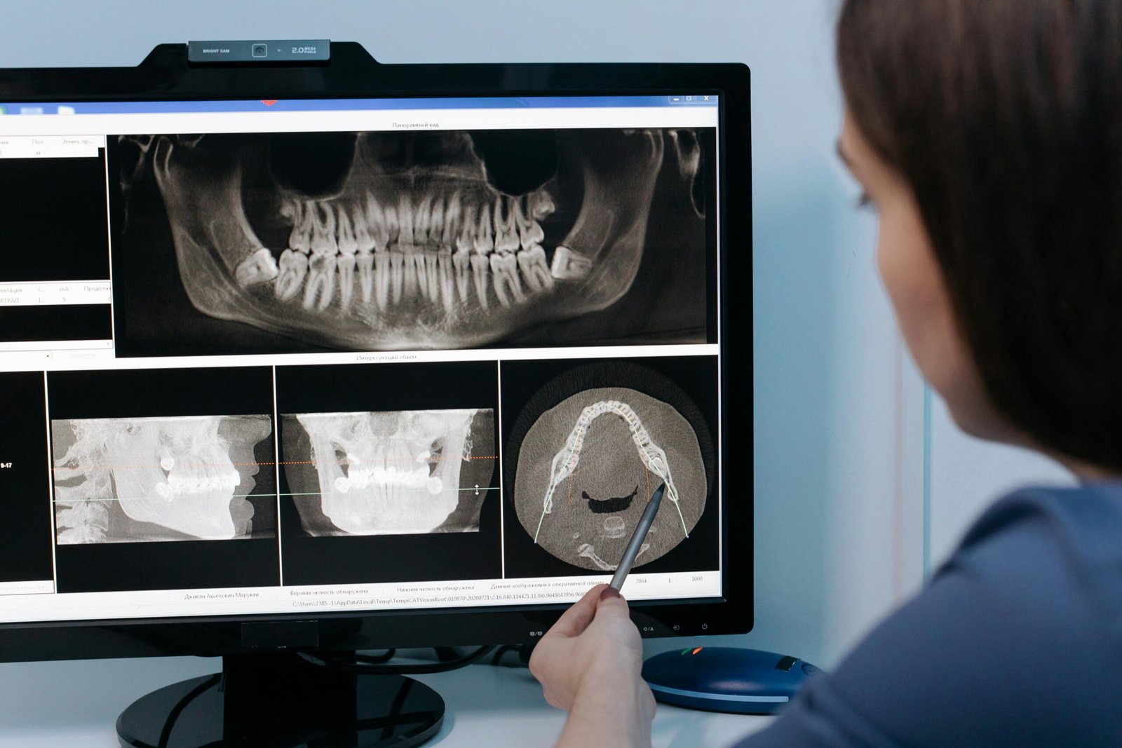 A dentist examines dental X-rays on a computer screen using a stylus for detailed analysis.