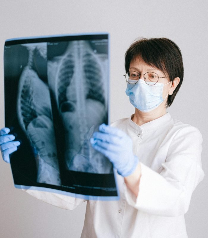 Medical professional in PPE examining chest X-ray results for diagnosis.